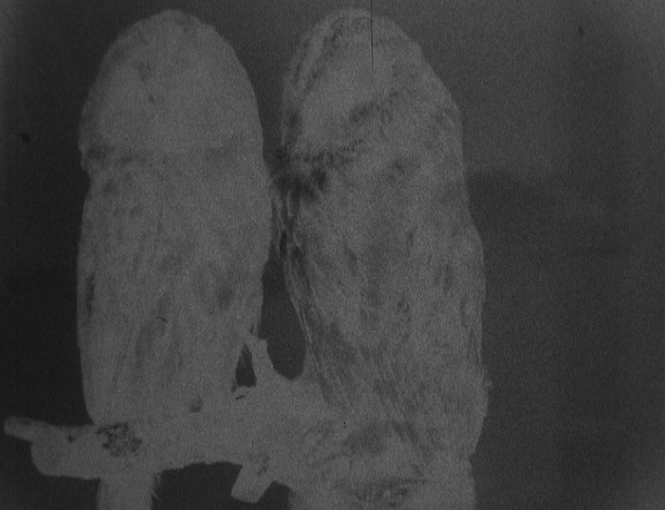 OJOBOCA — The Handeye (Bone Ghosts)